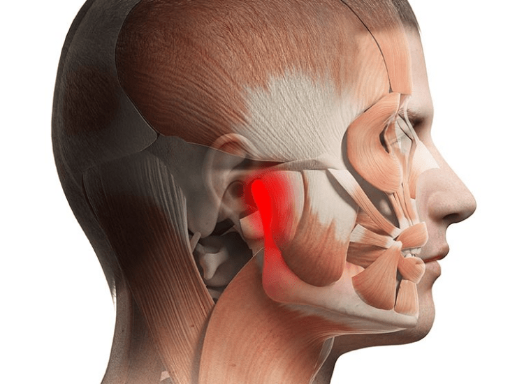 Orofacial Pain