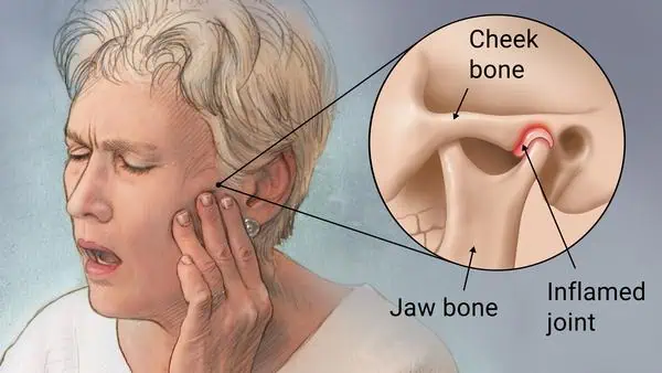 tmj treatment