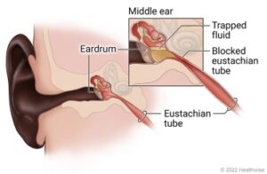 ENT Ear Nose Throat